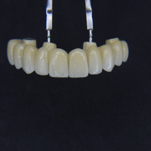 protese-fixa-parafusada