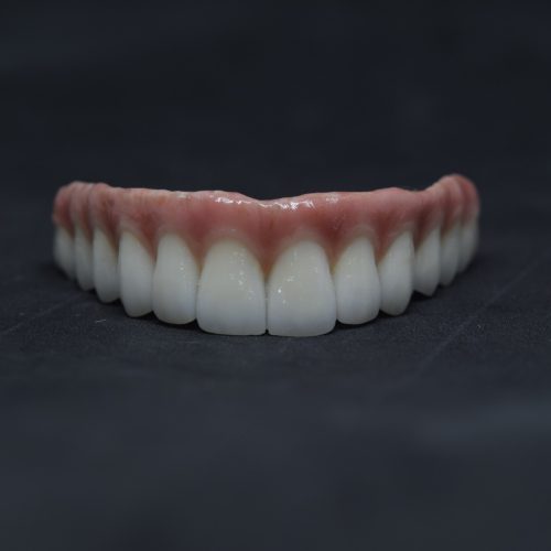 protocolo-sobre-implante